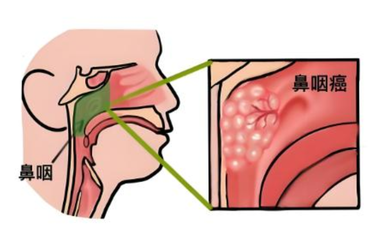 10 critical points from epic security manifesto inability